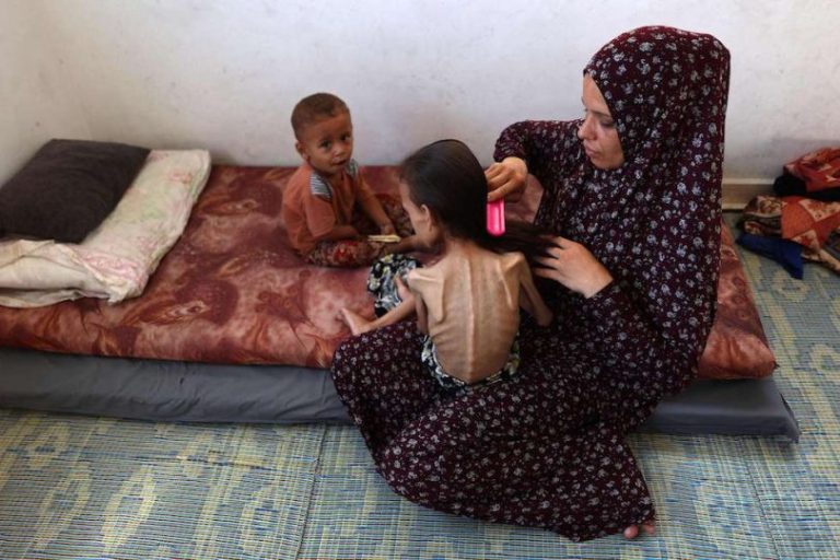 Malnutritian Malnutritian